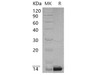 Human PCBD1 Recombinant Protein (RPES3527)