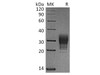 Human CREG/CREG1 Recombinant Protein (RPES3534)