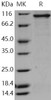 Human STK23/MSSK1/SRPK3 Recombinant Protein (His & GST Tag) (RPES3537)