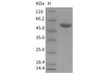 Mouse CNDP1 Recombinant Protein (His Tag) (Active) (RPES3540)