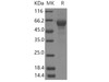 Human TRAP-alpha/SSR1 Recombinant Protein (Fc Tag) (RPES3542)