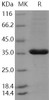 Human PCNA Recombinant Protein (His Tag) (RPES3558)