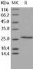 Human CD4/LEU3 Recombinant Protein (aa 1-208, His Tag) (Active) (RPES3560)