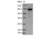 Rat GP1BB/CD42c Recombinant Protein (Fc Tag) (RPES3561)