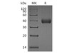 Human Kallikrein 11/KLK11 Recombinant Protein (RPES3575)