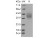 Mouse PILR-alpha/PILRA Recombinant Protein (His Tag) (Active) (RPES3584)