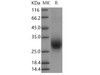 Human RAMP3 Recombinant Protein (Fc Tag) (RPES3585)