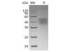 Human CD16a/FCGR3A Recombinant Protein (RPES3588)