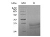 Human INSL3 Recombinant Protein (RPES3589)