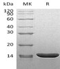 Mouse TNF-alpha/TNFA Recombinant Protein ((RPES3592)