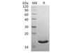 Human VAPB Recombinant Protein (RPES3595)