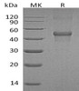 Human LMCD1/Dyxin Recombinant Protein (RPES3609)