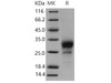 Mouse TNFRSF19/TROY Recombinant Protein (RPES3612)