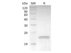 Rabbit TNF-alpha/TNFSF2/TNFa Recombinant Protein (RPES3618)