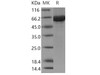 Human Cbl-c/CBL-3 Recombinant Protein (His & GST Tag) (RPES3619)