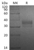 Human LAT2 Recombinant Protein (RPES3630)