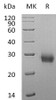 Human RANK/TNFRSF11A Recombinant Protein (RPES3631)