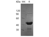 Human BUP1 Recombinant Protein (RPES3632)