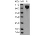 Mouse IL6ST/CD130 Recombinant Protein (RPES3633)