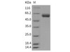 Mouse VNN1/Vanin Recombinant Protein (His Tag) (RPES3645)