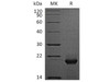 Human FTH Recombinant Protein (RPES3650)