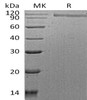 Human HER2/ErbB2 Recombinant Protein (RPES3652)