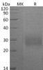 Human CD74 Recombinant Protein (His Tag) (Active) (RPES3665)
