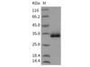 Rat CHODL/Chondrolectin Recombinant Protein (His Tag) (RPES3667)