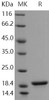 Human Alpha-Synuclein/SNCA Recombinant Protein (RPES3686)