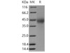 Human TMUB2 Recombinant Protein (His Tag) (RPES3692)