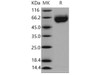 Mouse Axl Kinase Recombinant Protein (His Tag) (RPES3699)
