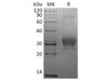 Human CSN3/CASK Recombinant Protein (RPES3704)
