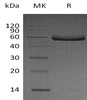 Human Fetuin-B/FETUB Recombinant Protein (RPES3716)
