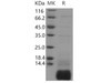 Human GNGT1/GNG1 Recombinant Protein (His Tag) (RPES3734)