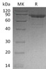 Human Cadherin1/CDH11 Recombinant Protein (RPES3736)