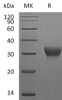 Mouse VSIG4 Recombinant Protein (RPES3742)