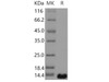 Human PTH2/PTRH2 Recombinant Protein (His Tag) (RPES3756)