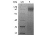 Rhesus macaque IFNAR1 Recombinant Protein (RPES3770)