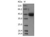 Rat ICOS/AILIM/CD278 Recombinant Protein (RPES3775)