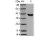 Mouse SerpinB8 Recombinant Protein (His Tag) (RPES3777)