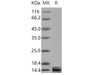 Mouse Galectin/LGALS1 Recombinant Protein  (RPES3784)