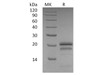Human VEGF165/VEGFA Recombinant Protein  (RPES3789)