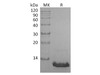Human CCL8/MCP-2 Recombinant Protein (RPES3790)