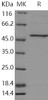 Human PAH/PH Recombinant Protein (RPES3793)