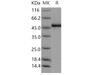 Human ADAMTSL1/PUNCTIN Recombinant Protein (RPES3799)
