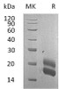 Rat GM-CSF/CSF2 Recombinant Protein (RPES3805)