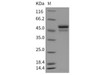 Mouse SerpinI1/Neuroserpin Recombinant Protein (His Tag) (RPES3818)