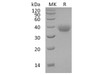Human OX40/TNFRSF4 Recombinant Protein (RPES3831)