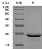 Human FGF2/FGF12 Recombinant Protein  (RPES3844)