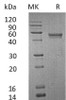 Human Lymphotactin/XCL1 Recombinant Protein (RPES3845)